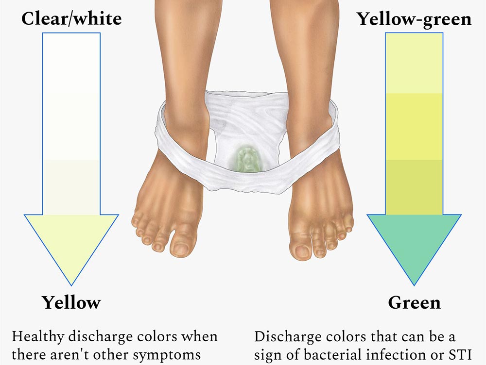 spremembe_noznica_izcedek